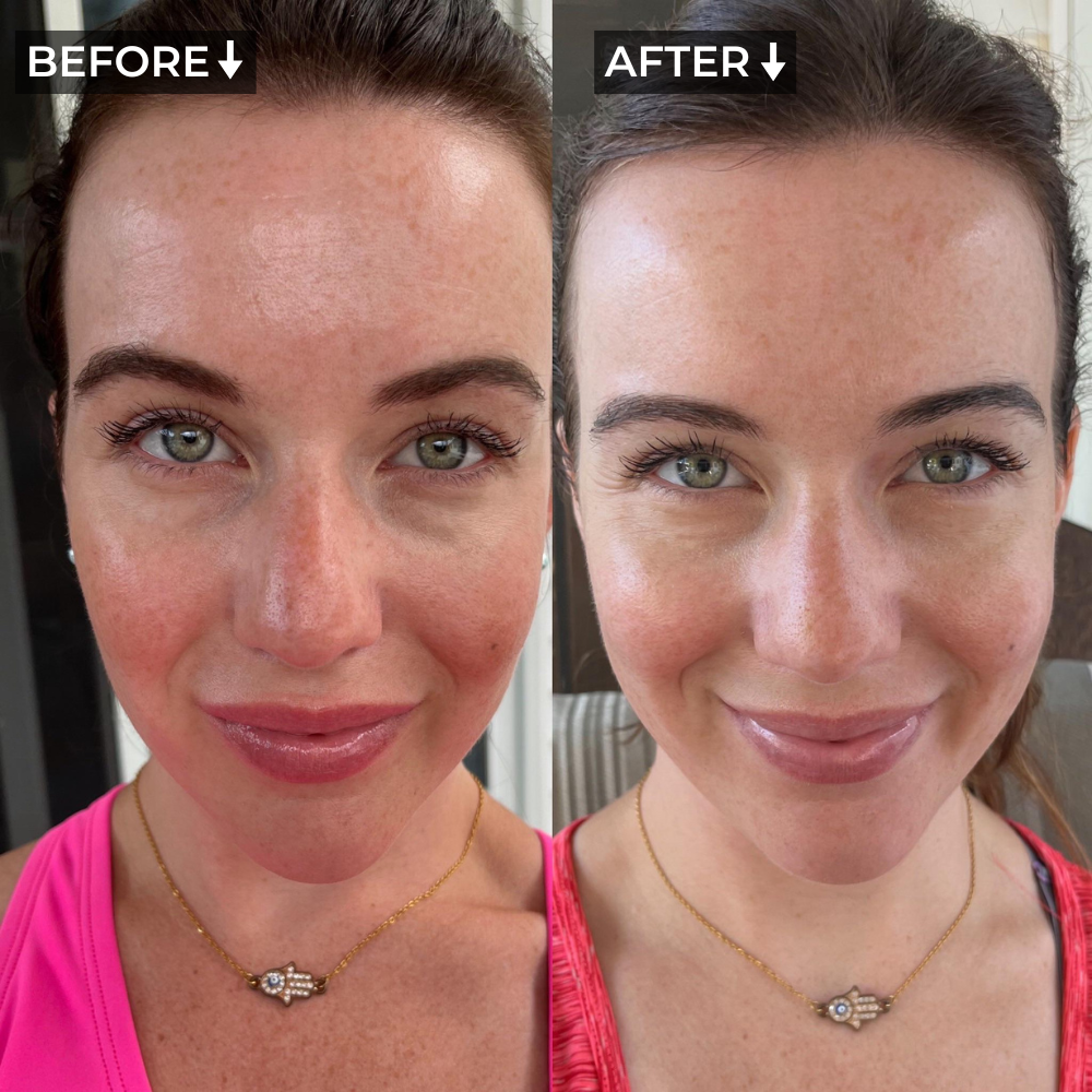 AURA+ Nuvibody® LED Masker