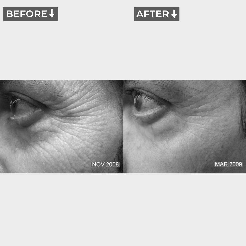 AURA+ Nuvibody® LED Masker