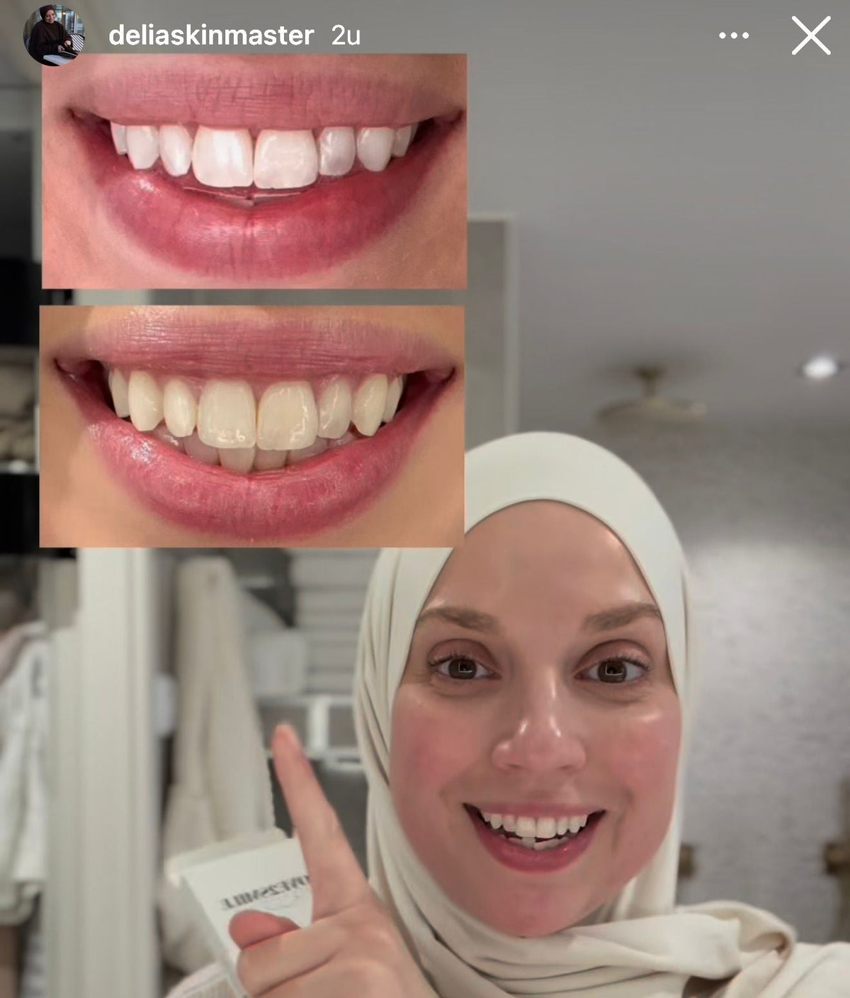 Ultimate Whitening Bundel