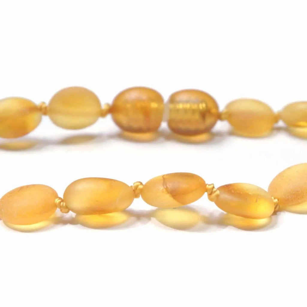 Barnsteen armbandje – ovalen ruwe kraaltjes – Honing – 14 cm